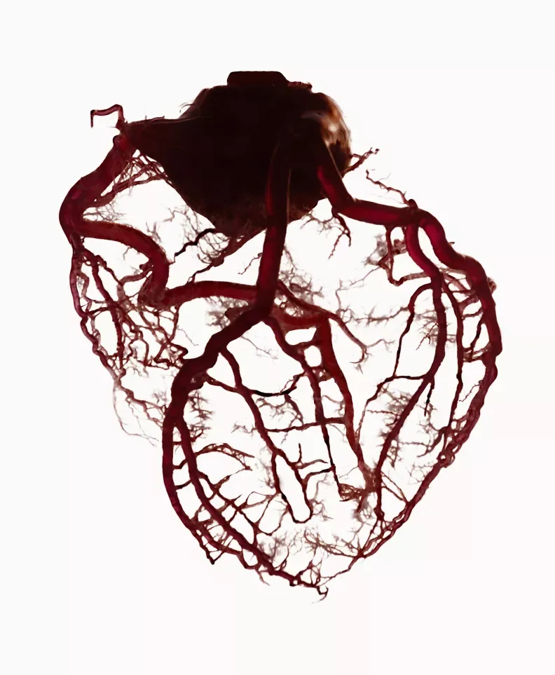 Anatomical heart diagram with red vascular structures shown after EECP treatment