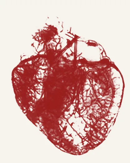 Line-art anatomy illustration of the heart shown before EECP treatment