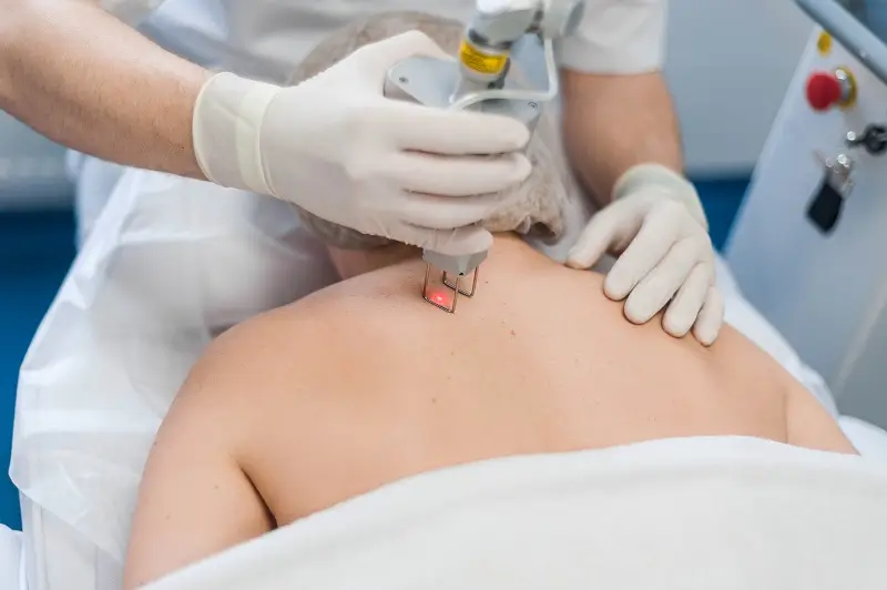 Practitioner applying a handheld cold laser to a patient's upper back at ChiroPrime Orlando