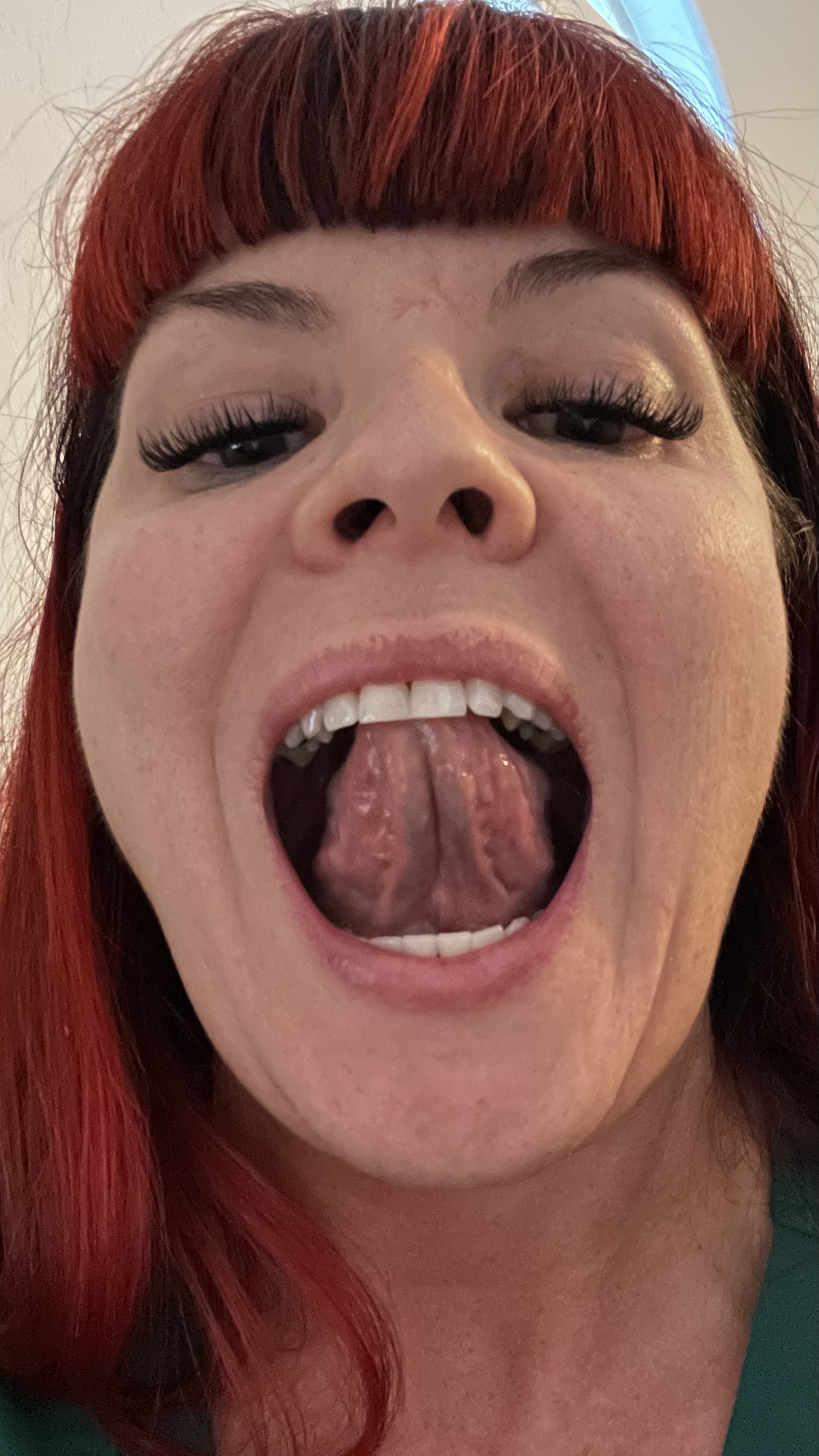 Samantha Medeiros demonstrating a myofunctional tongue elevation exercise with her tongue raised to the roof of her mouth