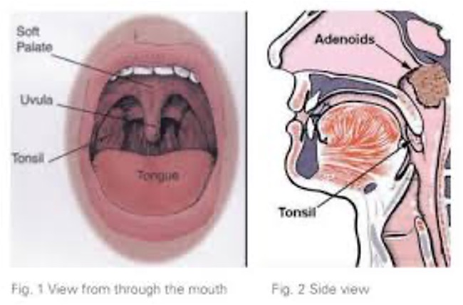 Mouth and throat anatomy diagram showing oral structures affected by tongue tie and myofunctional therapy