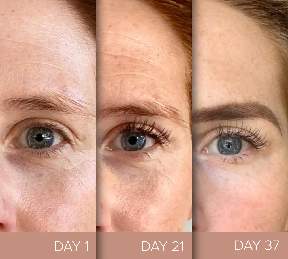 Collagen results over time